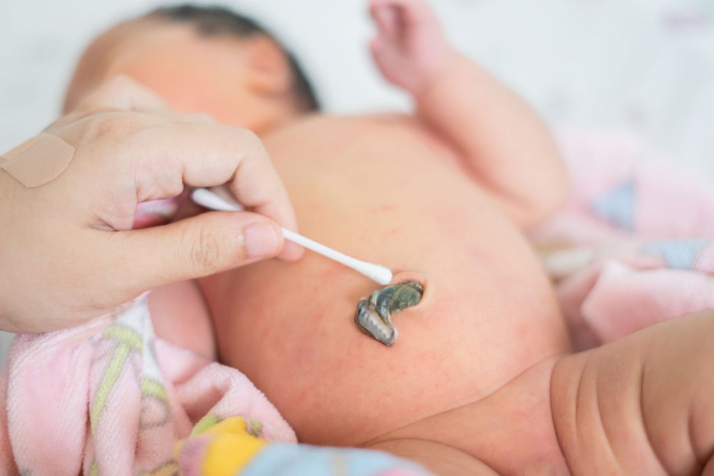 cum îngrijești cordonul ombilical