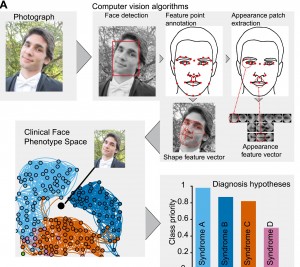Computer programme detects genetic illness by mapping faces