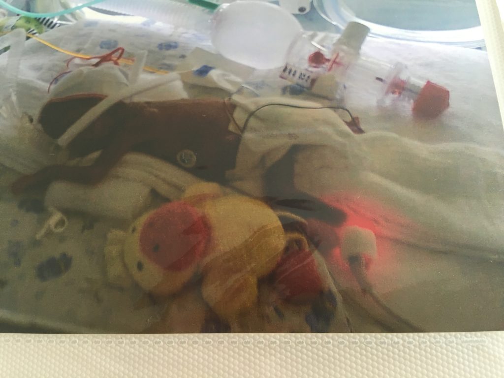 prematur in incubator