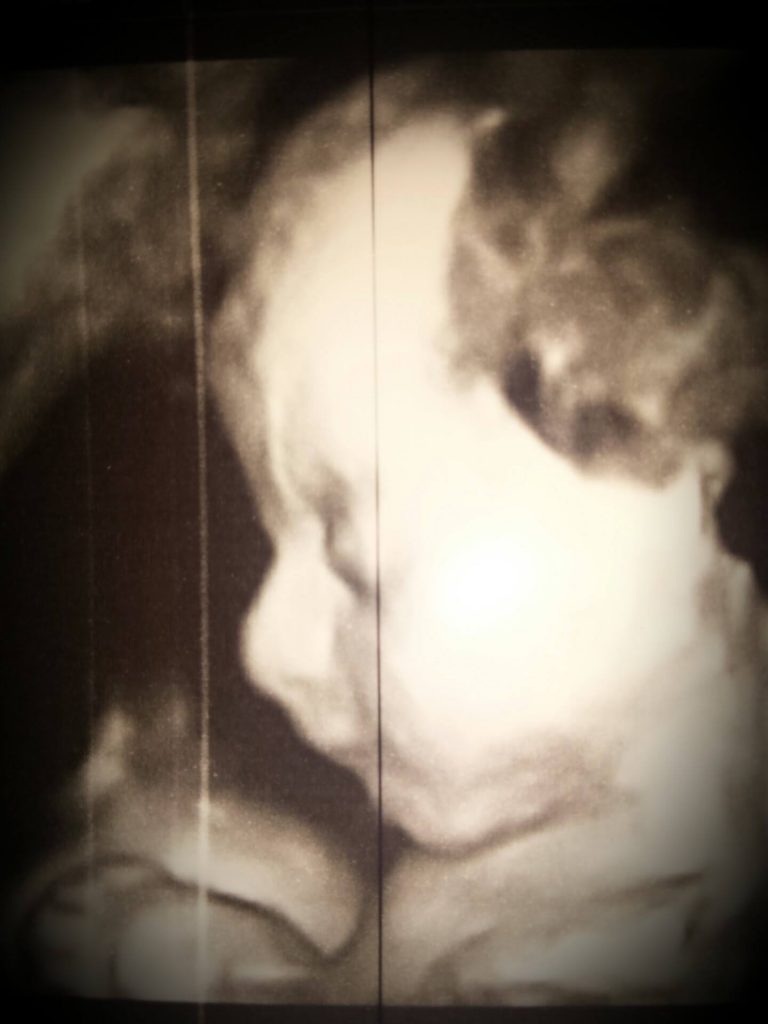 13588895_745770155566183_317413501_o