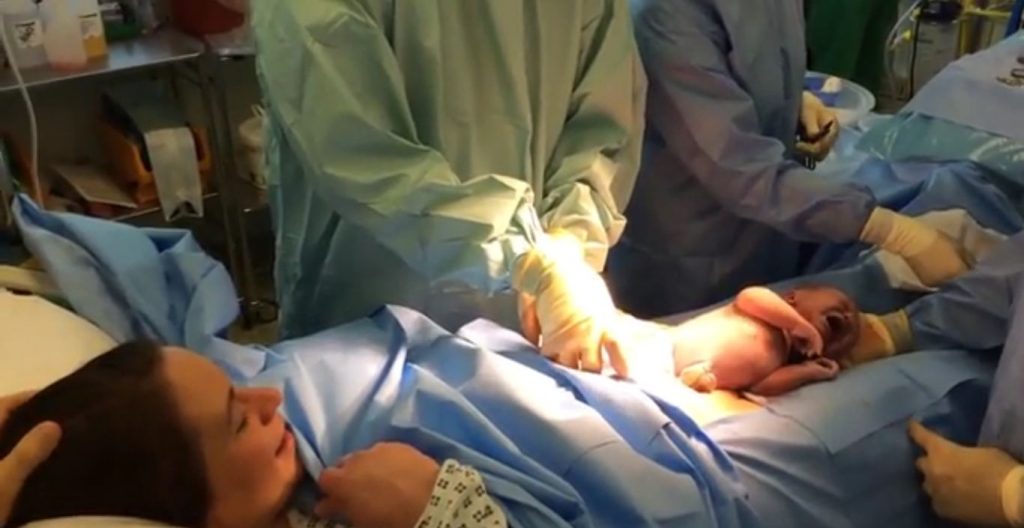 nastere prin cezariana