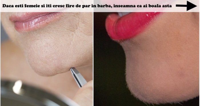 daca esti femeie si iti cresc