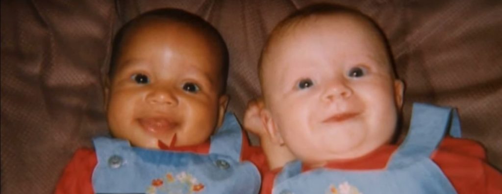 gemene culoare piele diferita