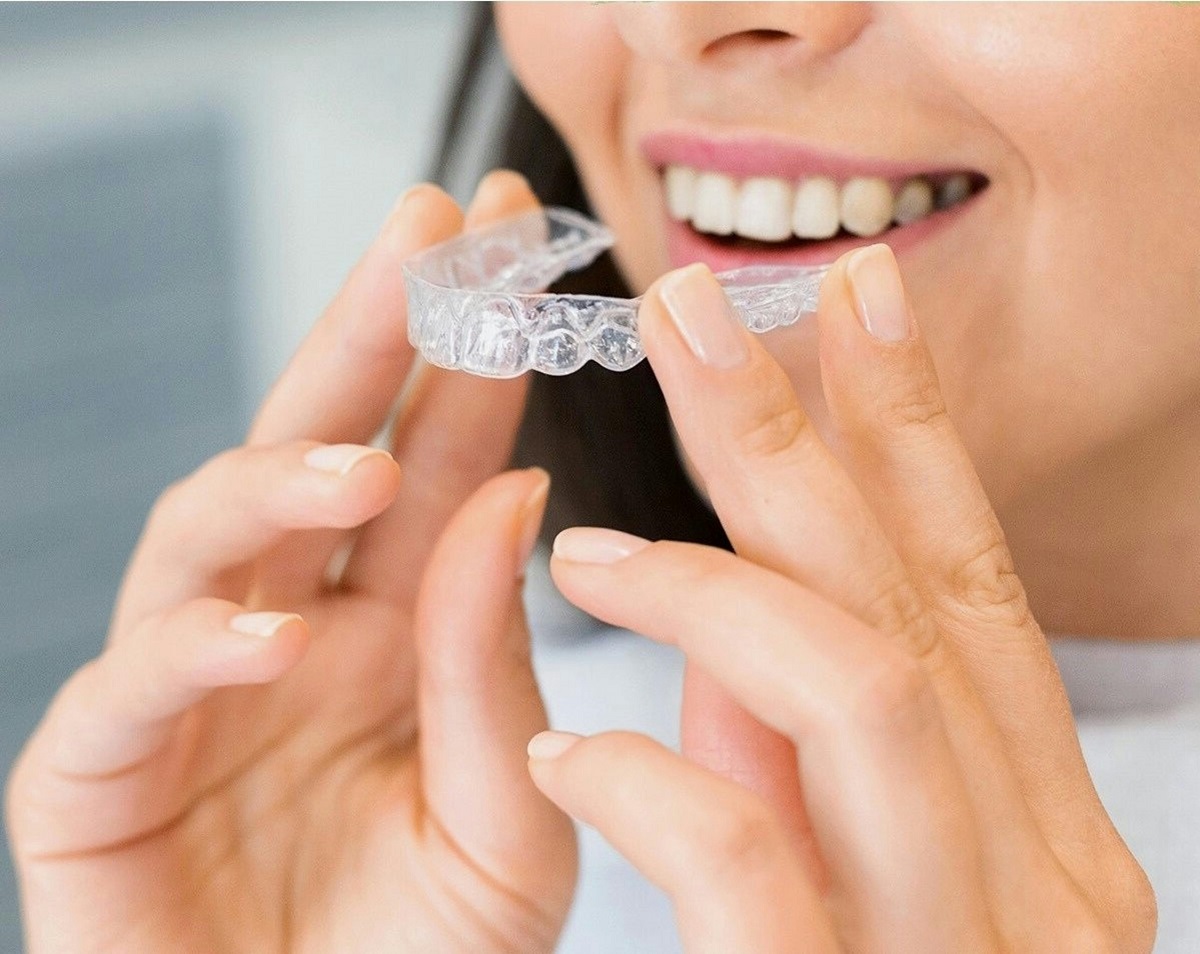 Din Ce Material Sunt Realizate Gutierele Unui Aparat Dentar Invisalign