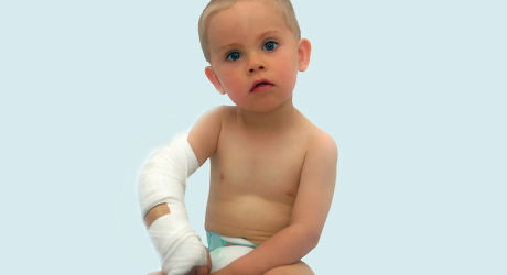 ortoped, sanatate, ghips, fractura