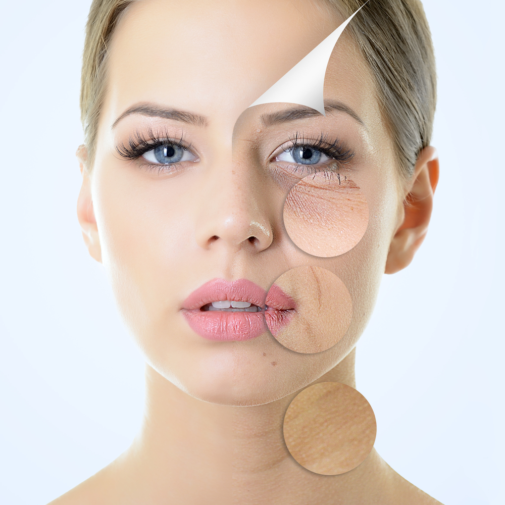 Botox injecțiile în jurul ochilor - consecințele probabile și eliminarea lor