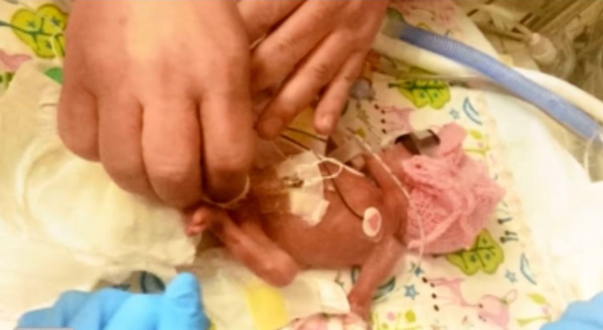 Imaginile Unui Adevărat Miracol Primul An Din Viața Unui Prematur Născut La 24 De Săptămani Video Revista Baby Pentru Părinti și Copii